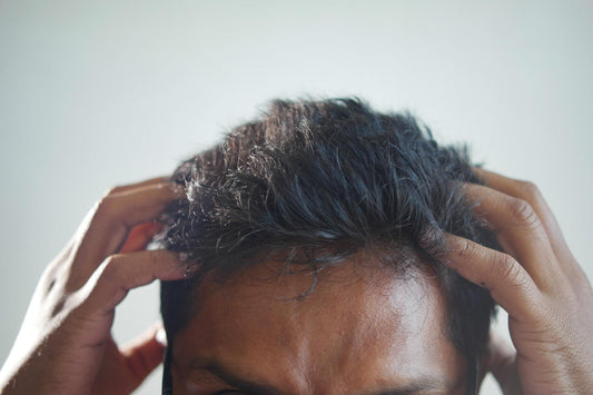Signs of an Unhealthy Scalp! Featured Image