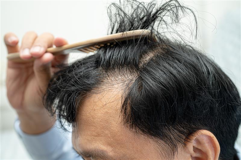Signs Your Hair Follicles Are Regrowing! Featured Image 00136